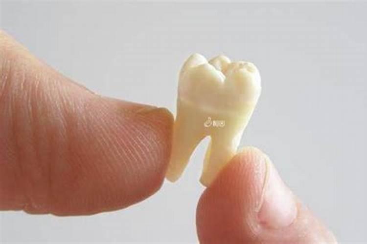 掉牙齿是什么预兆