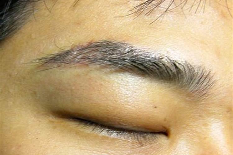 眉头有伤疤会影响财运吗
