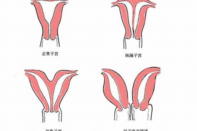 双子宫是什么意思