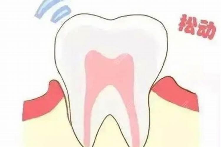 梦见牙松动了自己给拔下来了啥意思