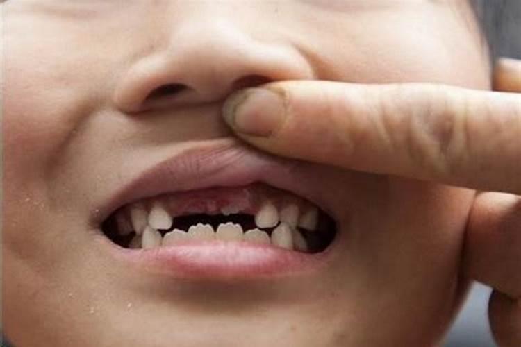 梦见掉牙齿是什么征兆孩子